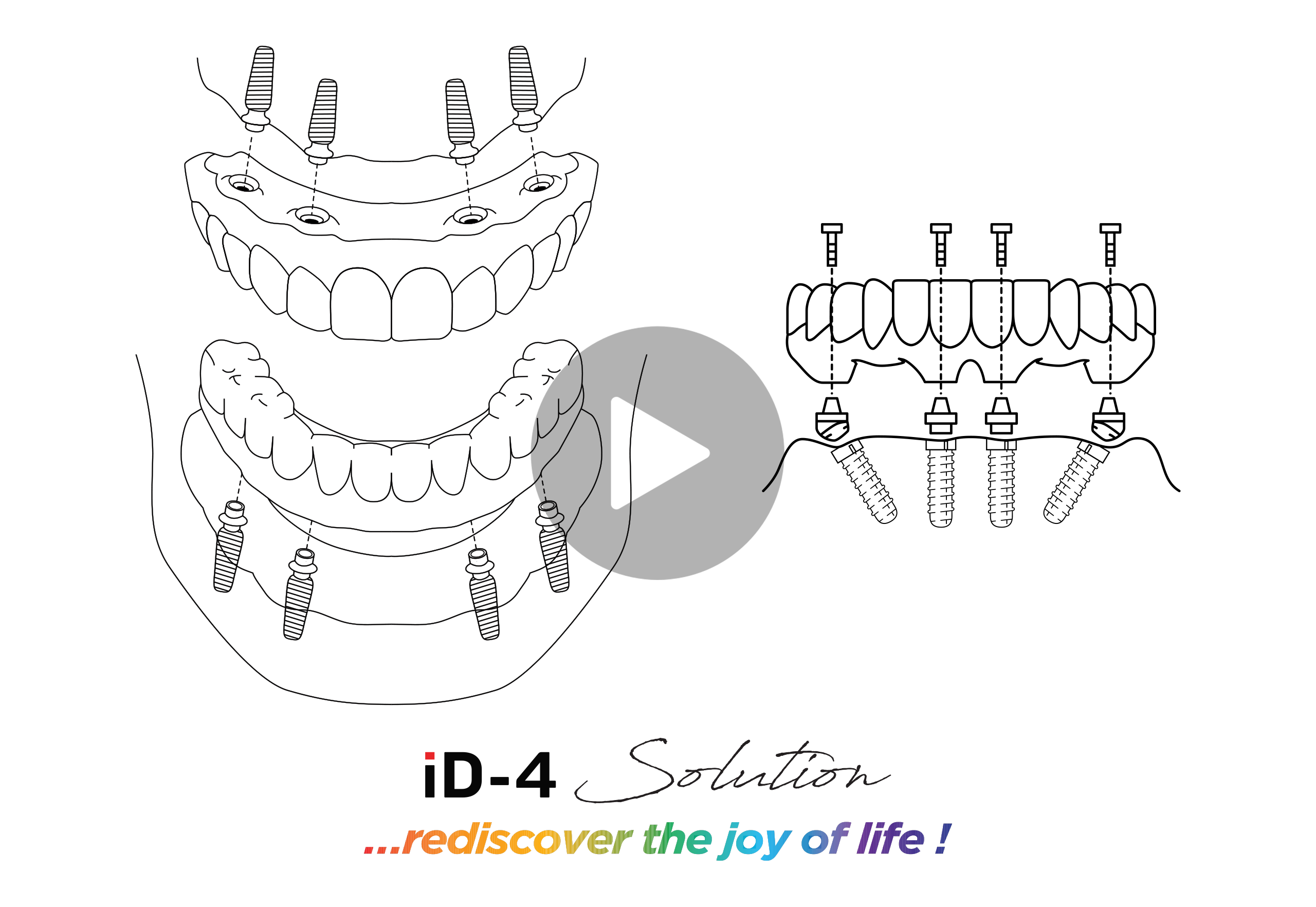 Ảnh Bìa Video iD4 Stackable Guide