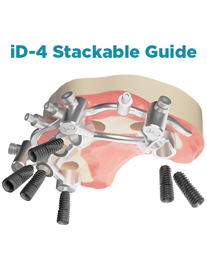 máng id4 stackable guide