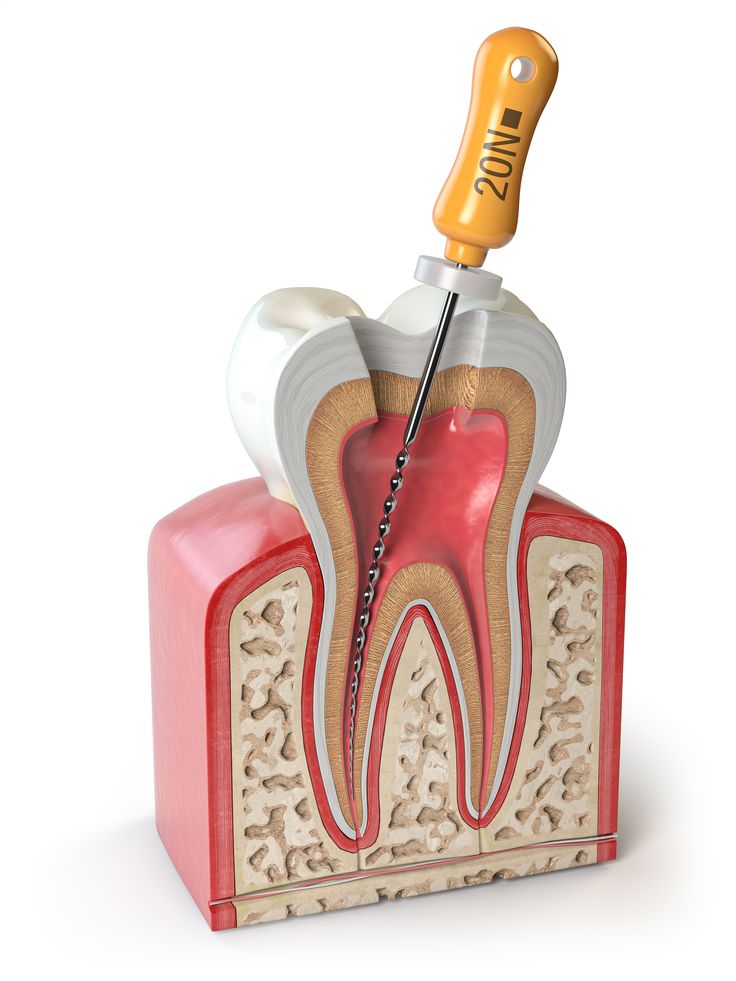 Cross section of Human tooth with endodontic file isolated on wh