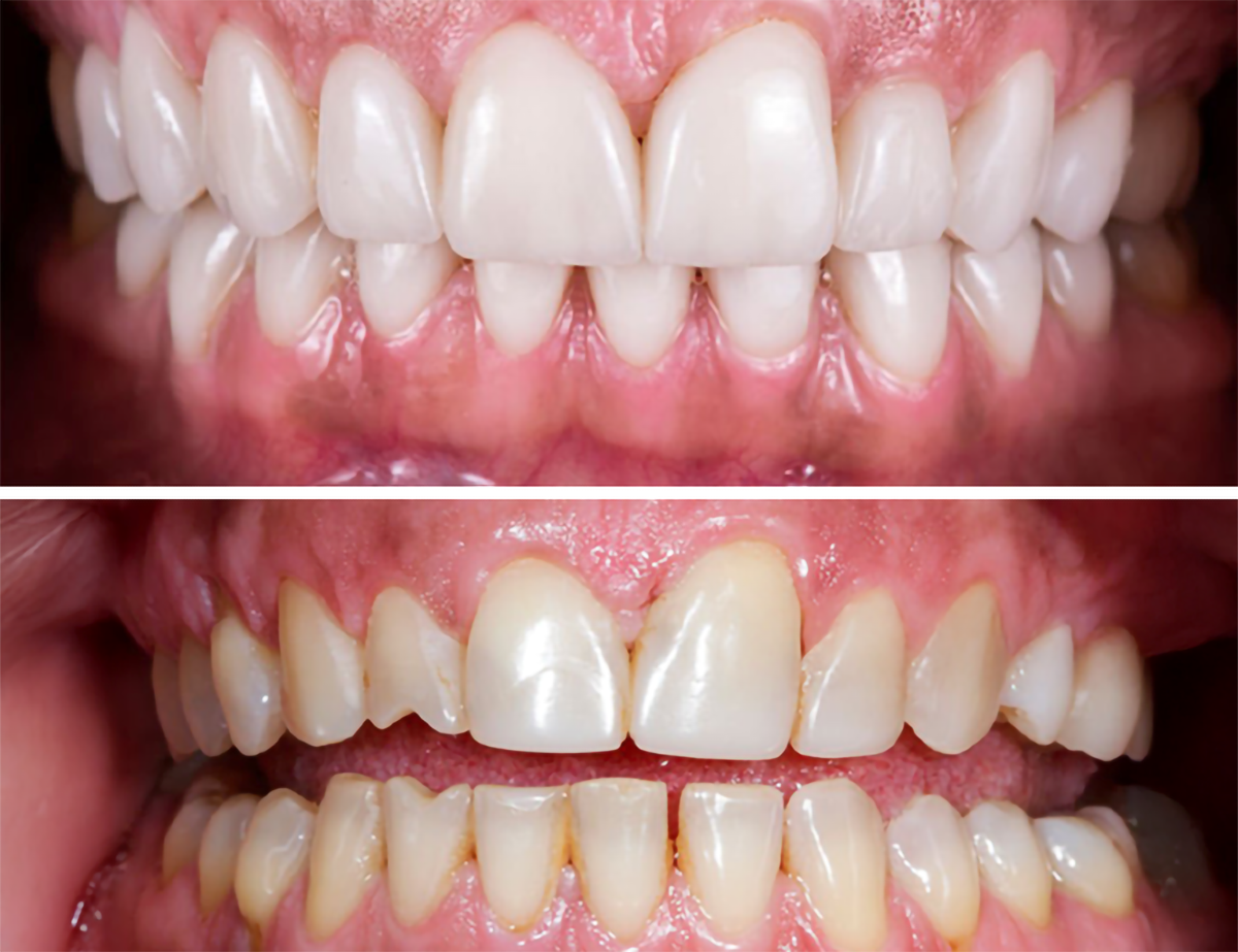 review-before-after-1