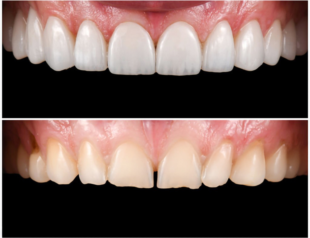review-before-after